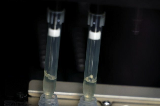 Spain Leads Europe in Monkeypox, Struggles to Check Spread