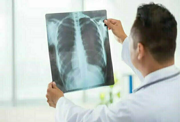 Signs You May Require an X-ray