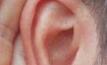 NIOSH plans hearing loss seminar