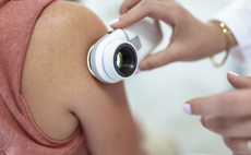 Bupa integrates AI into skin cancer checks