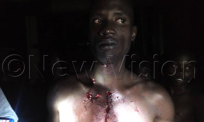 Fisherman survives being mauled by crocodile Fisherman survives being mauled by crocodile