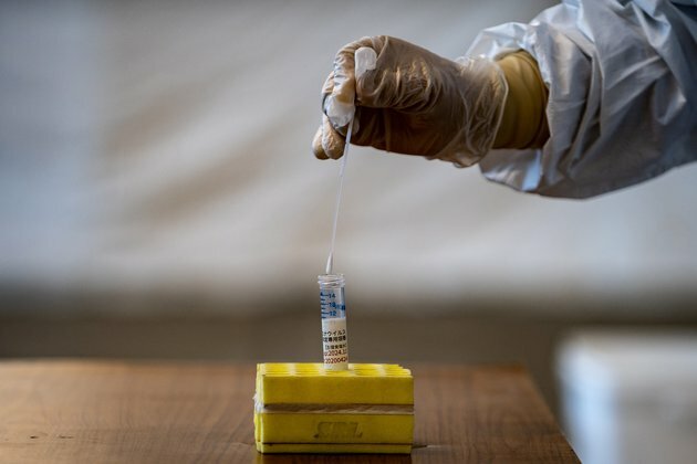 Japan to Start COVID-19 Antibody Testing Next Month