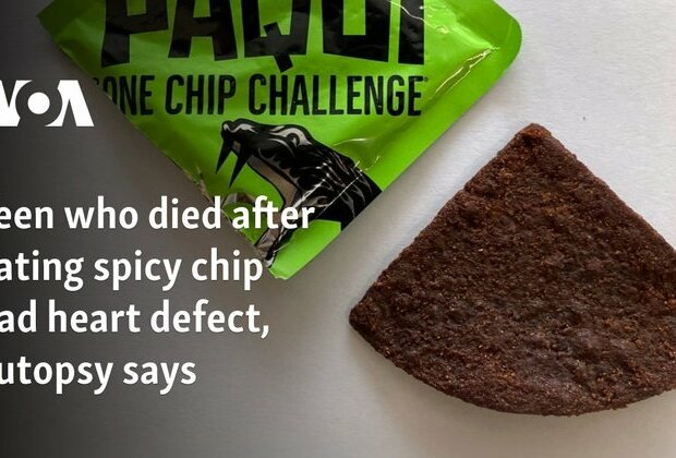 Teen who died after eating spicy chip had heart defect, autopsy says