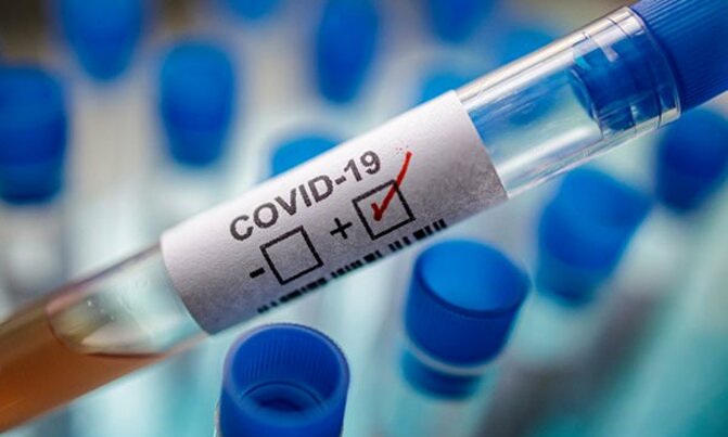 World surpasses 20 million coronavirus cases, WHO warns against despair