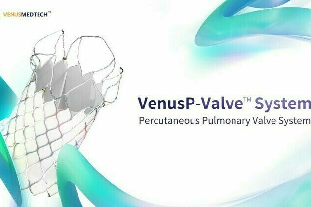 Filling gap in market: VenusP-Valve approved by China's NMPA