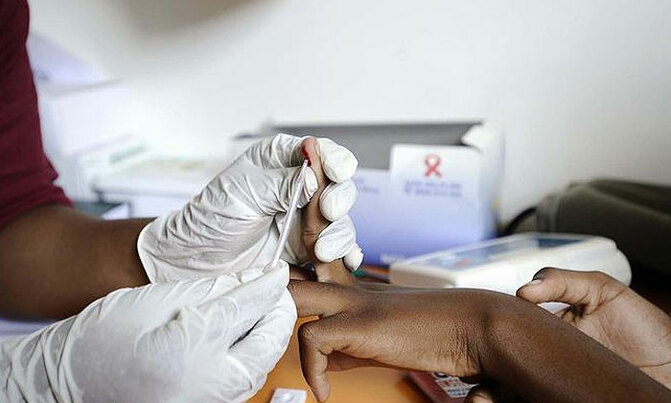 HIV/AIDS pandemic lingers despite successes HIV/AIDS pandemic lingers despite successes