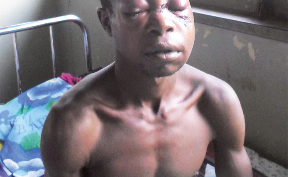 Kavuma mu ddwaaliro e Kiboga. Kavuma mu ddwaaliro e Kiboga.