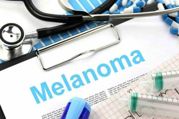 High-risk local melanoma patient benefit from immunotherapy