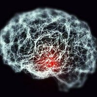The TGA has approved donanemab for Alzheimer's disease. How does this drug work and who will be able to access it?
