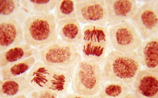 NVM leads £2m round for Newcells Biotech