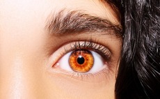 KKR, 5Y lead Series C for China contact lens brand