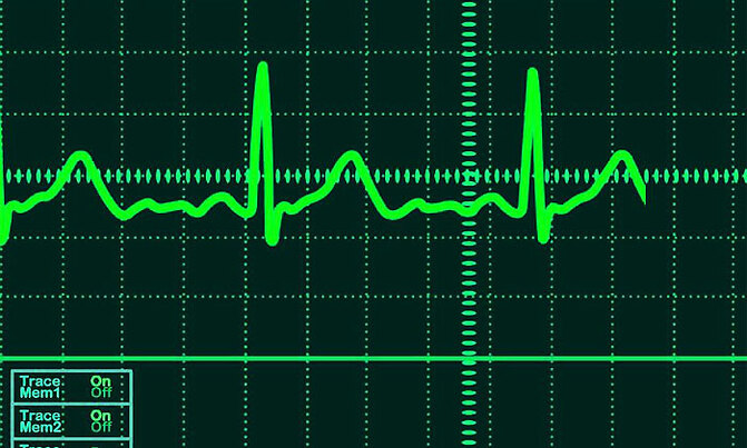 Heart attack: 'Death more likely for women if it's male doctor' Heart attack: 'Death more likely for women if it's male doctor'