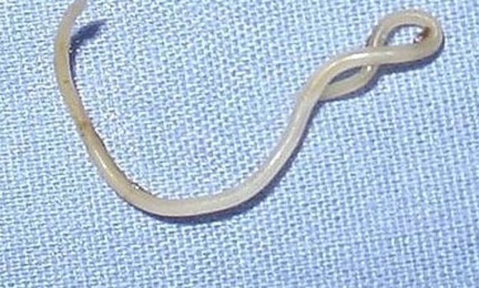 Johnson & Johnson tackles intestinal worms Johnson & Johnson tackles intestinal worms