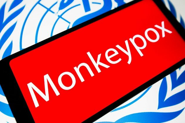 Moscow comments on global monkeypox outbreak