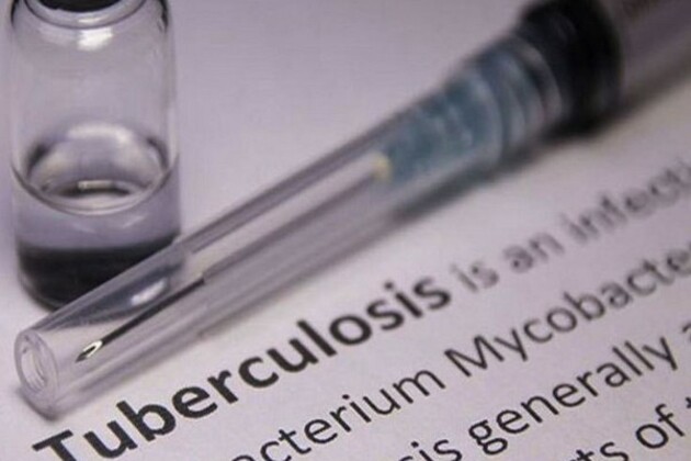 ICMR-NIE introduce alert feature to reduce TB deaths in Tamil Nadu