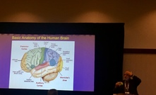 Dr Stephen Enders explains the anatomy of the human brain