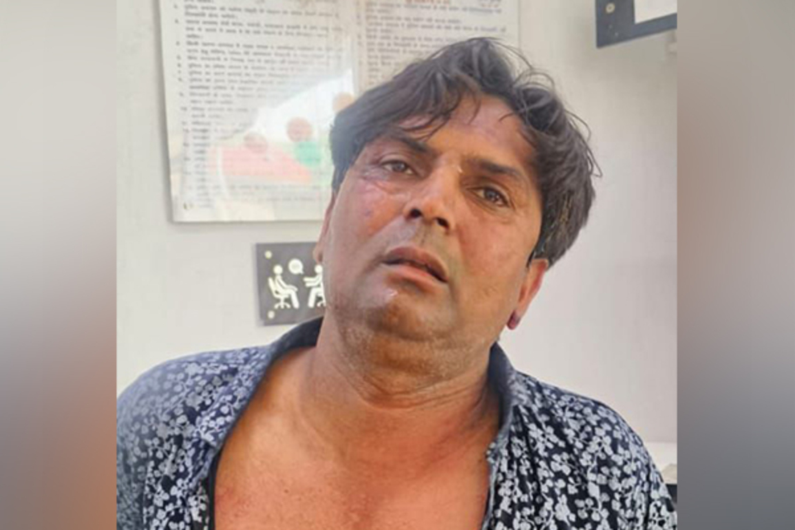 Delhi CM attack case: Accused taken into police custody; IB, Special Cell interrogate him