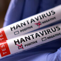 Eight Hantavirus cases reported; three dead, six confirmed Andes Virus: WHO