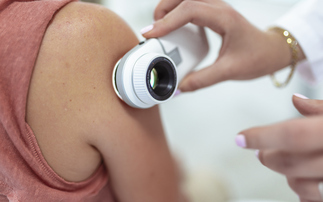 Bupa integrates AI into skin cancer checks