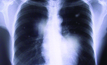 The guidelines provide guidance on frequency of respiratory health surveillance.