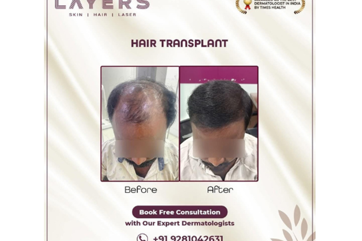 Rapid Nationwide Expansion: Layers Skin and Hair Clinics Continues to Sculpt Beauty Inside and Out