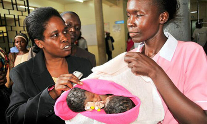 Ten-man medical team to handle Kumi Siamese twins Ten-man medical team to handle Kumi Siamese twins
