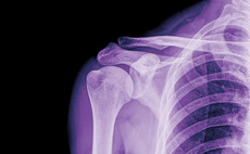 Lifeline et al. in €5.1m funding round for Synoste