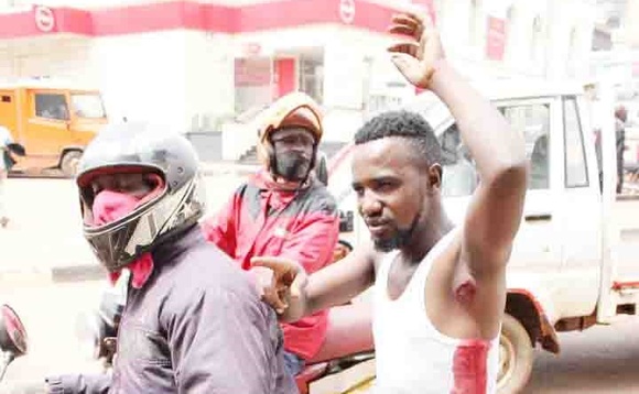 Omuvubuka eyakubiddwa essasi nga bamutwala mu ddwaaliro. Omuvubuka eyakubiddwa essasi nga bamutwala mu ddwaaliro.