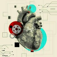 An artificial heart may save your life. But it can also change you in surprising ways