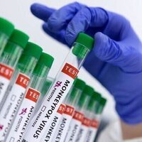 DR Congo declares end of mpox outbreak after two years