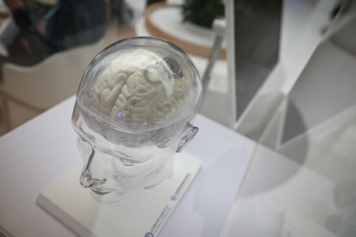 China's brain-computer interface innovation in fast lane