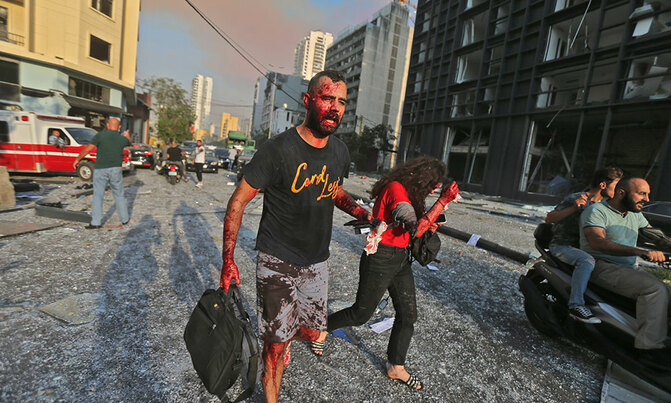 'Deaths and hundreds wounded' in Beirut blasts 'Deaths and hundreds wounded' in Beirut blasts