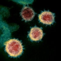 Long-COVID, viruses and 'zombie' cells: new research looks for links to chronic fatigue and brain fog