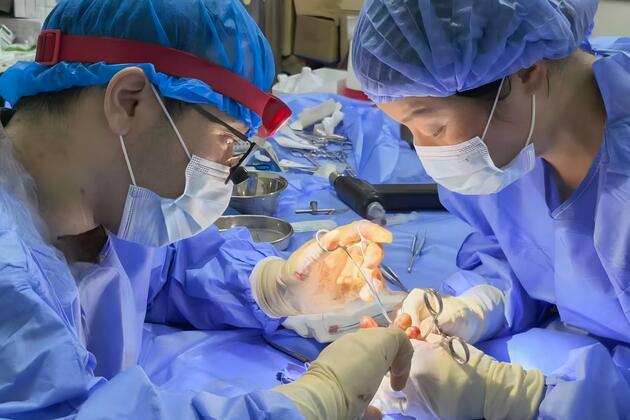 SIERRA LEONE-FREETOWN-CHINESE-MEDICAL TEAM-FINGER REPLANTATION SURGERY