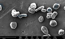  Spheroidised graphite particles under the electron microscope.