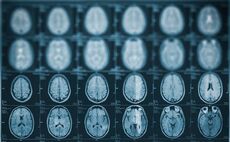 Horizons leads Series B for Australia healthcare AI start-up  