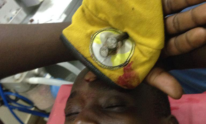 NRM supporter's hands nailed for donning party colours NRM supporter's hands nailed for donning party colours