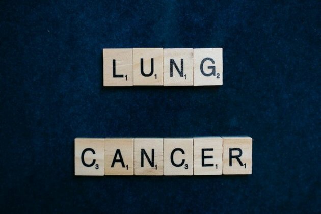 Tumour matrix profiling can predict some lung cancers' progression