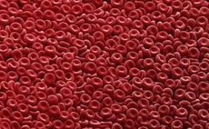 Singapore cancer treatment start-up gets $126m Series A