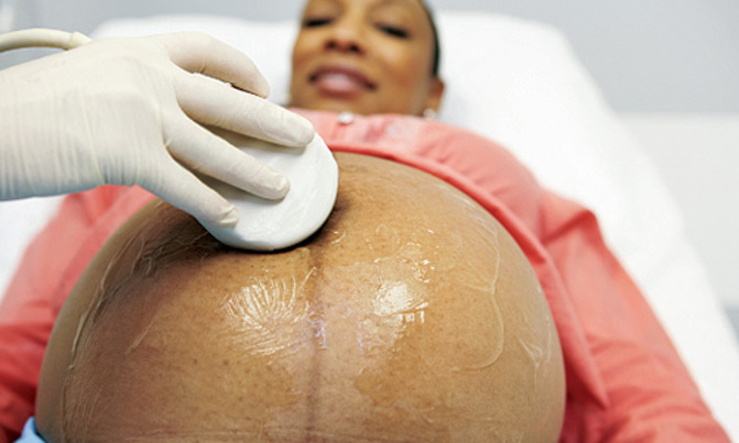 Midwives: Are they the devils they are painted as? Midwives: Are they the devils they are painted as?