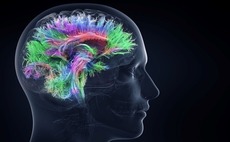 Deal focus: Biotech gets more cerebral 