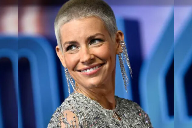 Evangeline Lilly shares pictures of gruesome injuries she sustained after fainting