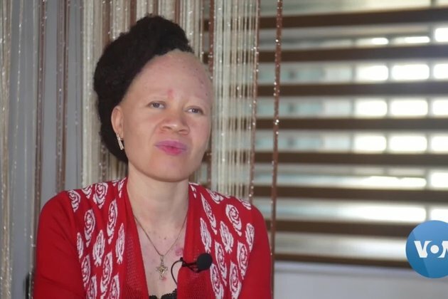 Nigerian Albinos Demand Authorities Restore Free Cancer Treatment