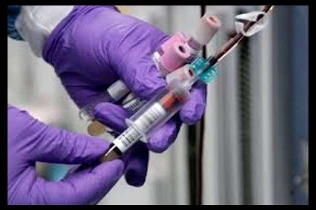 Simple blood test may enhance diagnosis rate of severe liver disease