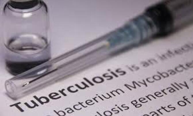 Scientists inventing new TB vaccine Scientists inventing new TB vaccine