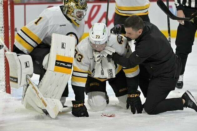 Bruins D Charlie McAvoy hit in face by puck vs. Canadiens, ruled out