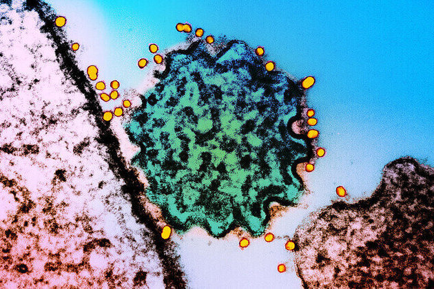 Indian virus scare: Media hits panic button over Nipah outbreak