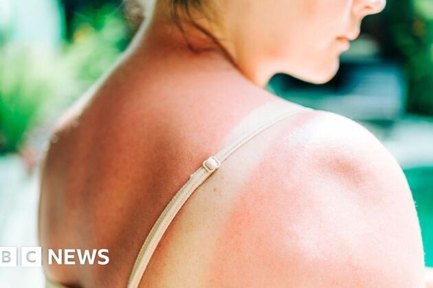 Riskiest skin cancer cases hit UK record high
