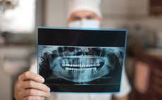 Vitruvian leads €45m round for Dental Monitoring