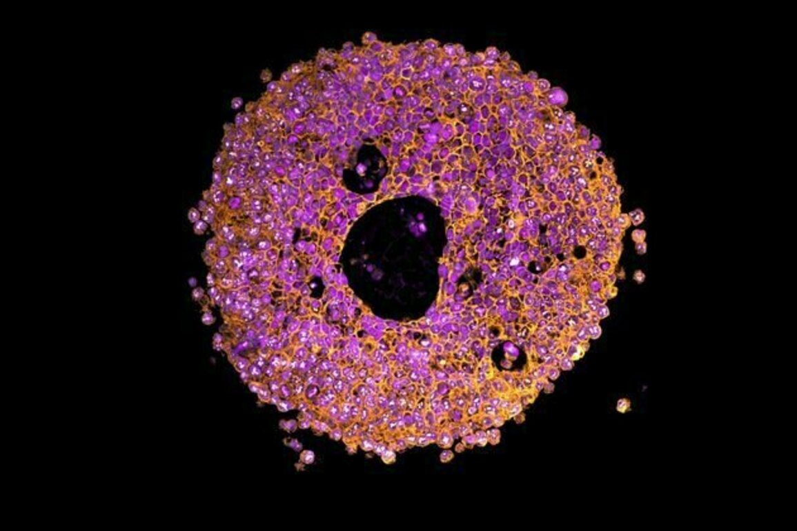 3D printed mini-placentas offer a new way to study pregnancy complications